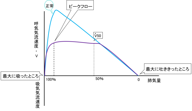 Flow-volume curve　4